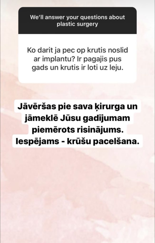 Jautājumi un Atbildes