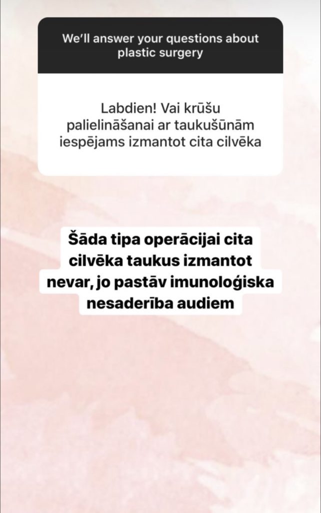 Jautājumi un Atbildes