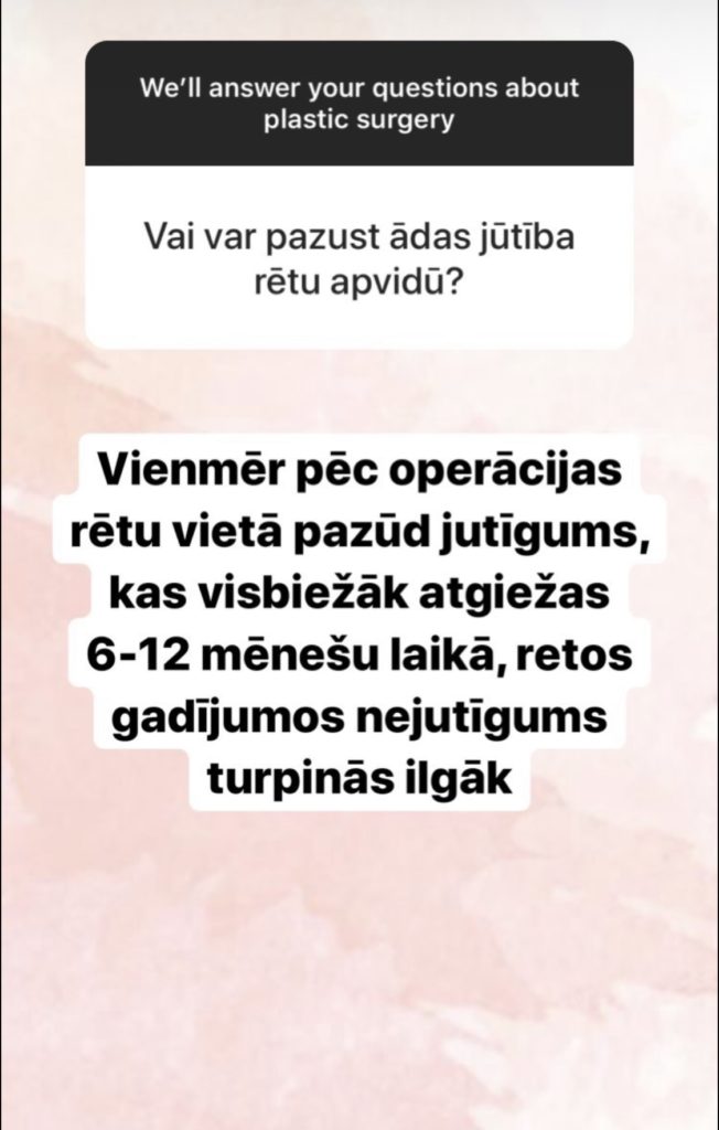 Jautājumi un Atbildes