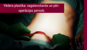 Vēdera plastika