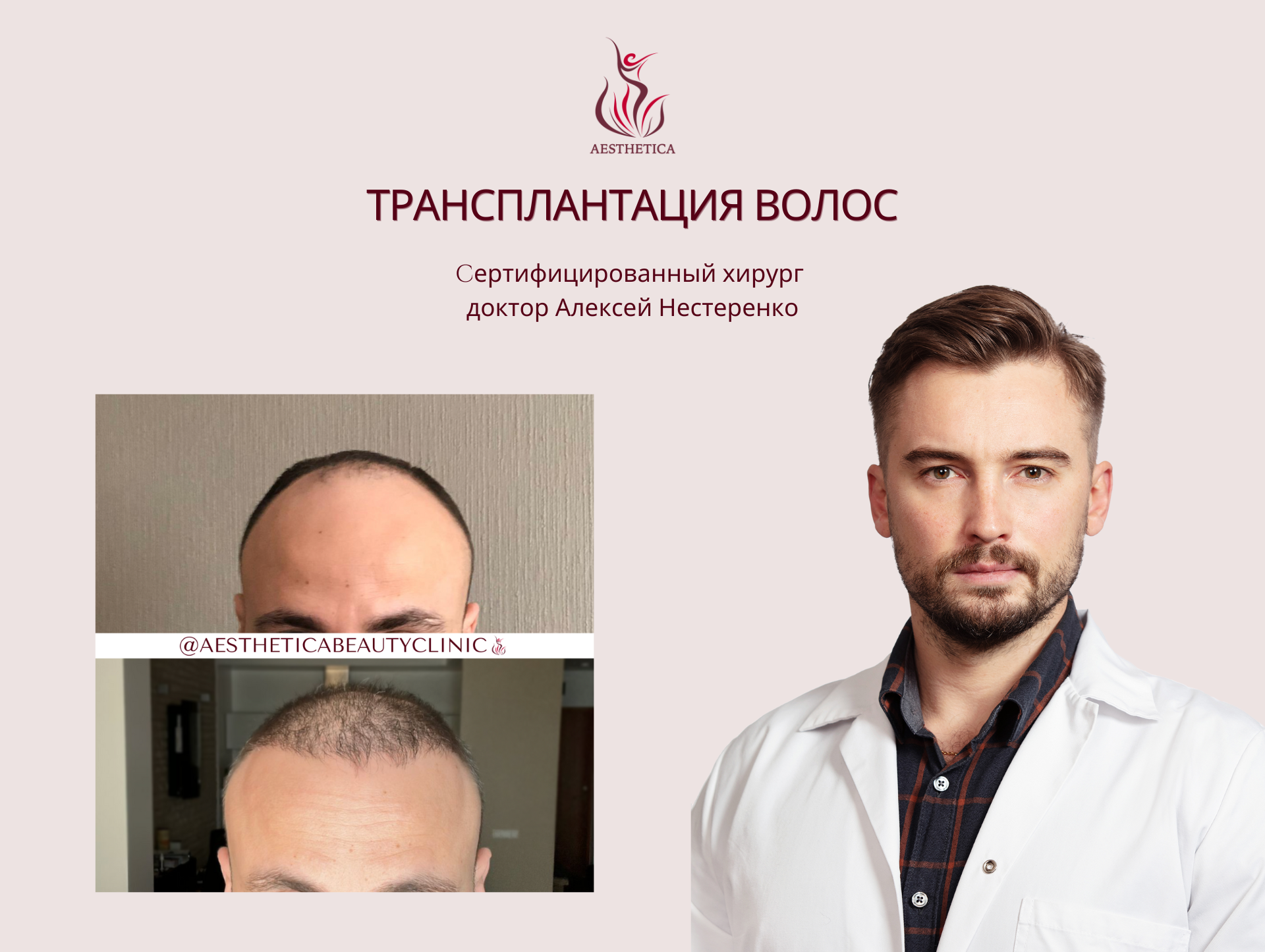 Transplantacia Volos