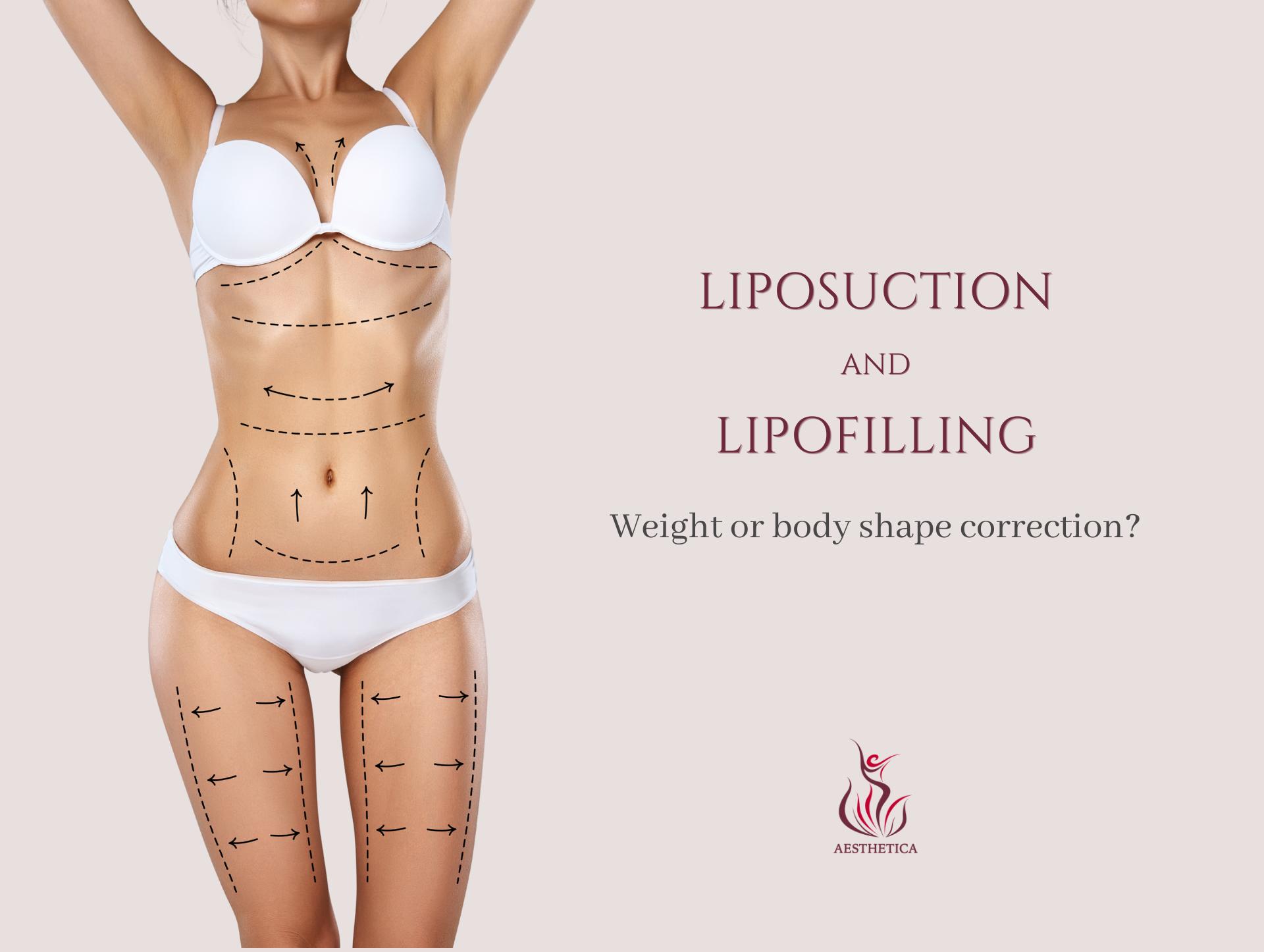 Liposuction and lipofiling